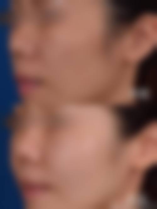 樊福全擅长项目列表