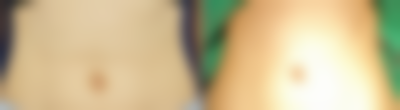 武汉洪山爱美汇整形美容交通路线与预约