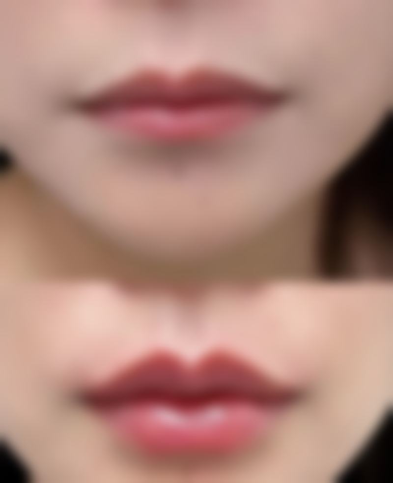 沈阳和平美兮如美人医疗美容门诊部患者评价