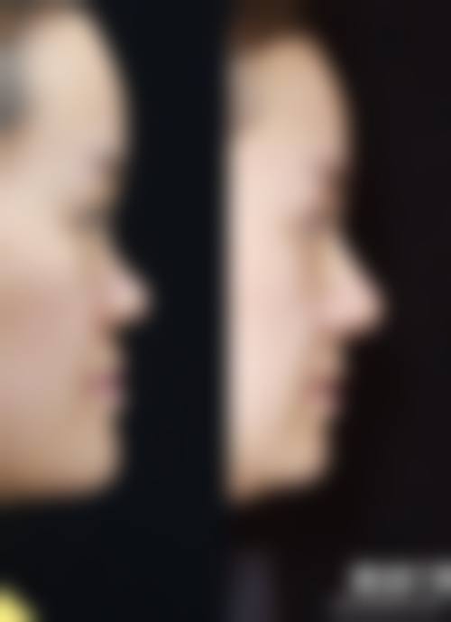 太原针美汇医疗美容门诊部求美者反馈