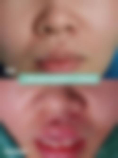 成都医学校第一附属医院烧伤整形科患者评价