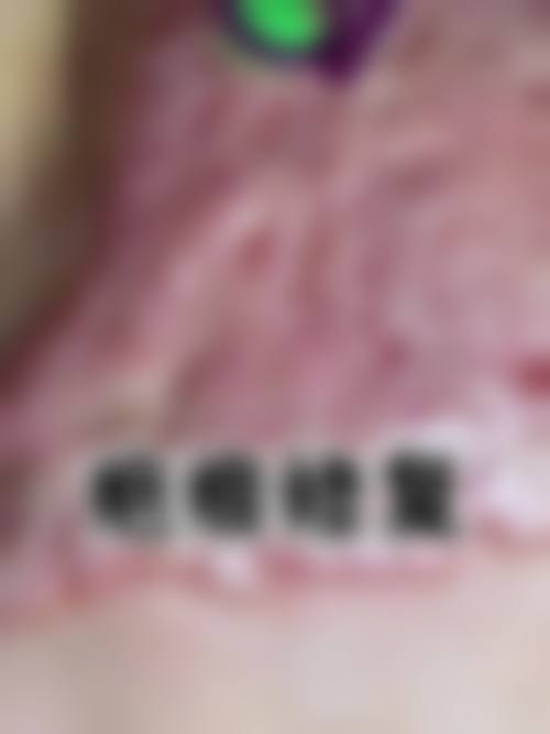 济宁市第二人民医院整形美容科患者评价