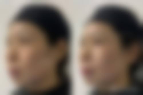 邢台市人民医院整形美容科正规资质