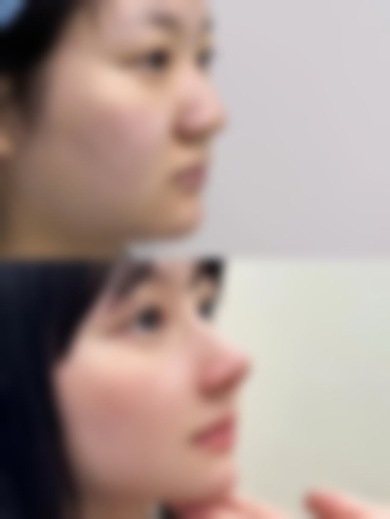 株洲宇芳姬整形医院核心项目