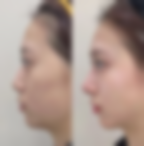 成都医学校第一附属医院烧伤整形科地址及到院路线