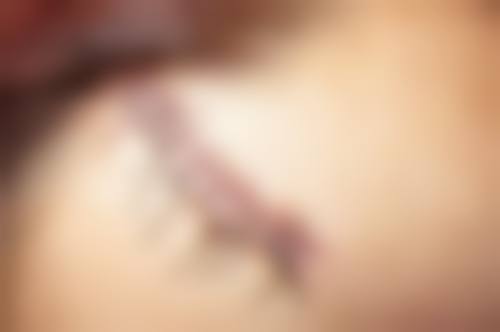 长沙长海植发科价格参考