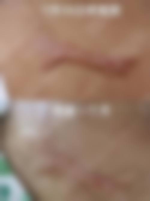 长沙长海植发科交通路线与预约