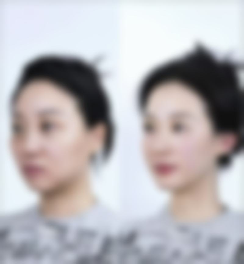 柳州医美整形医院核心项目