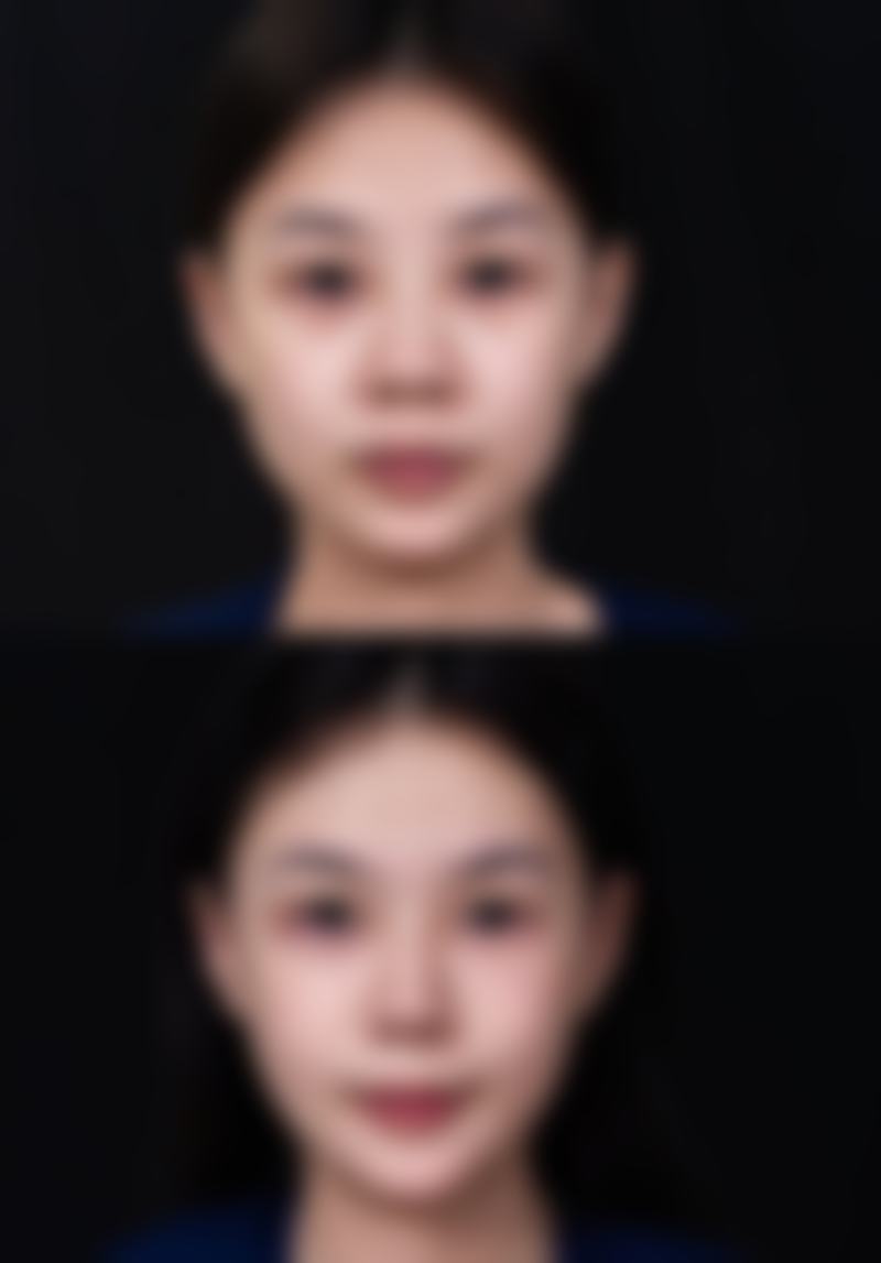 赖运泰擅长项目列表