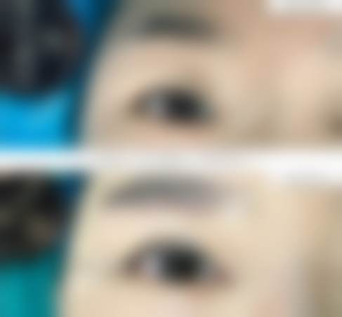 广州韩后整形美容医院患者评价