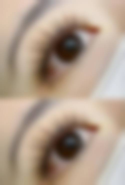 成都瑞丽诗植发整形美容医院价格参考