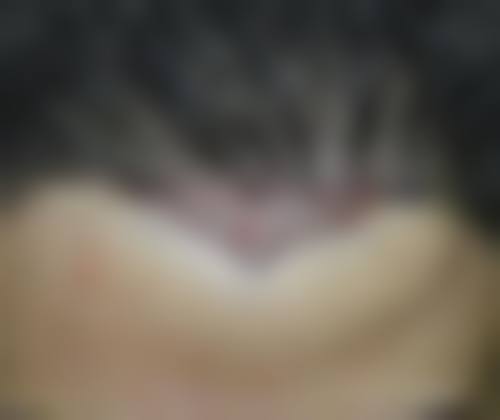 成都瑞丽诗植发整形美容医院患者评价