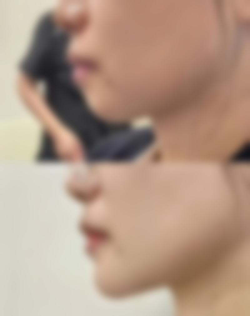 重庆普瑞缇医疗美容诊所价格参考