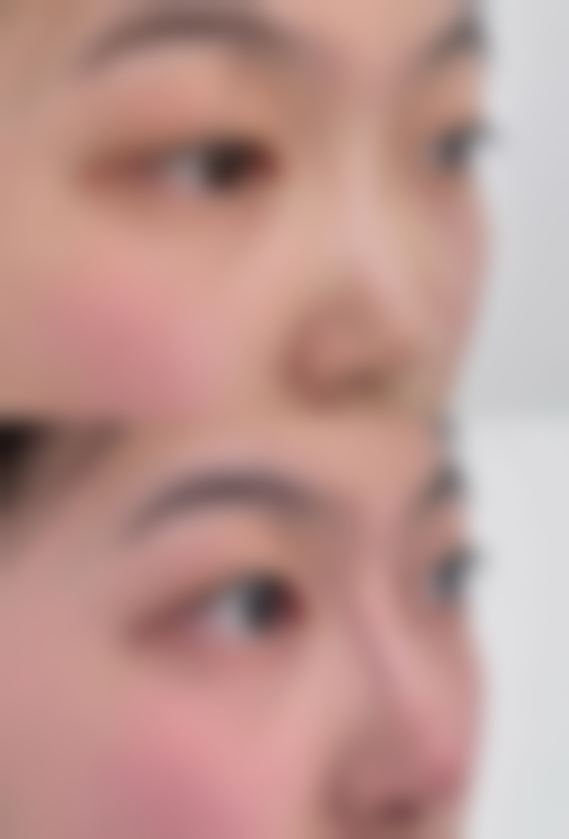 湖南益阳雅美丽人医疗美容服务体验