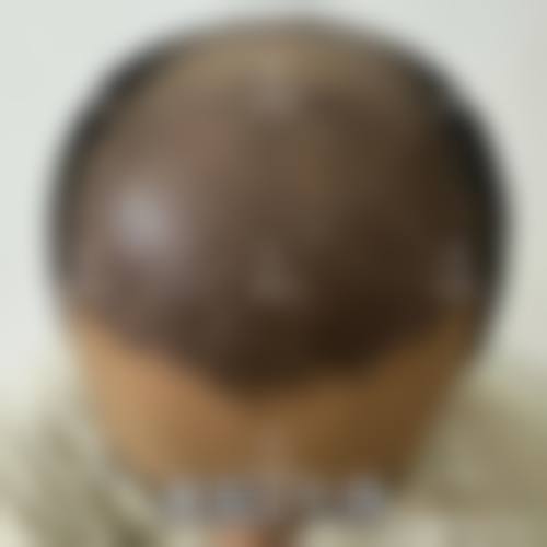 安宁袁刚琼医疗美容诊所核心项目