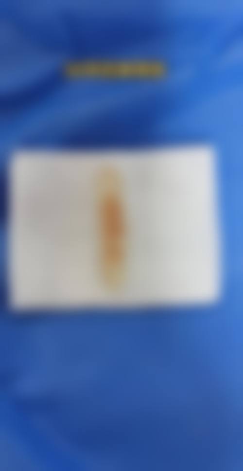 深圳流花医院整形美容科核心项目