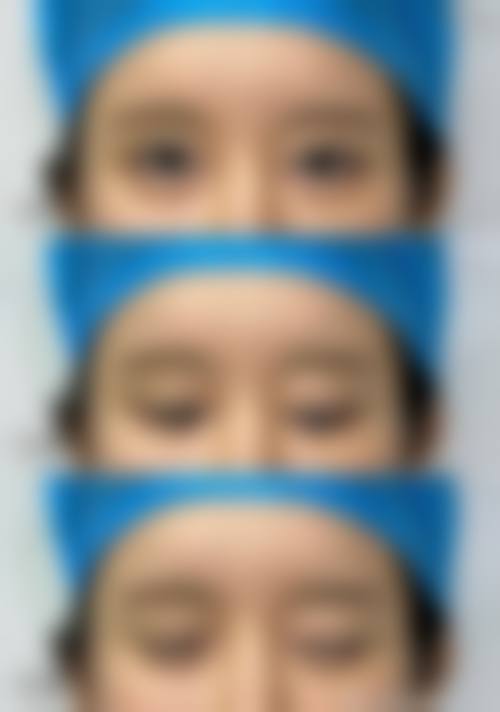 成都米兰柏羽整形医院患者评价