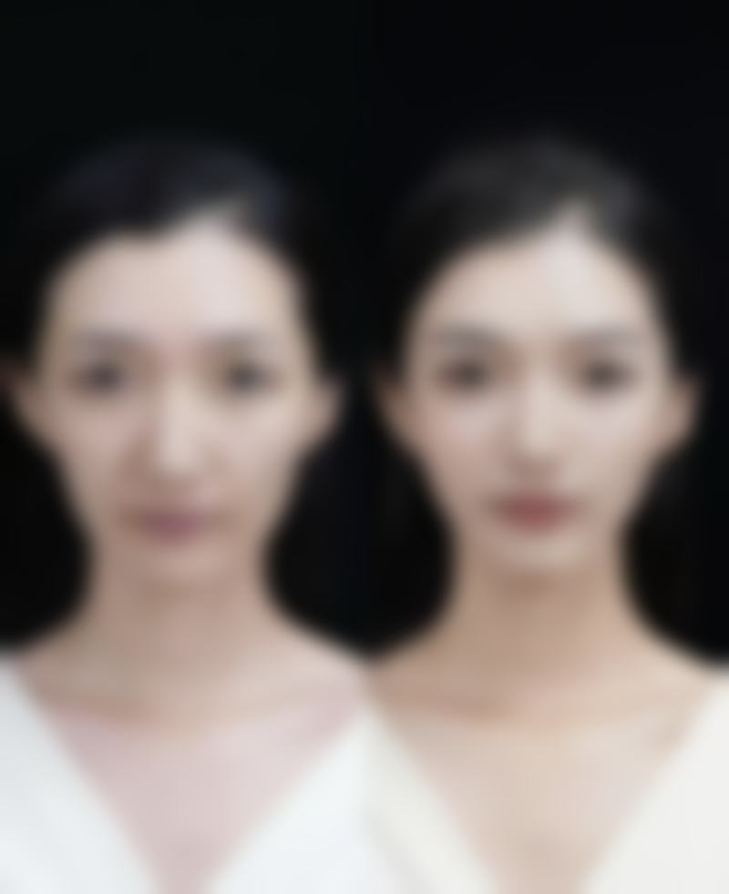 深圳美合悦秀整形医院核心项目