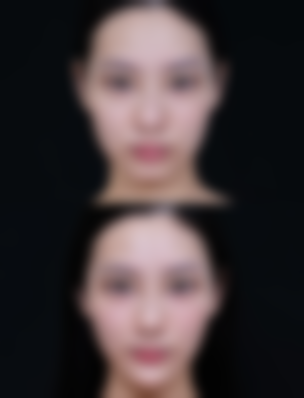 深圳孙力美容皮肤科诊所价格参考