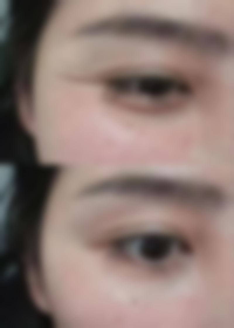 成都米兰柏羽整形医院核心项目