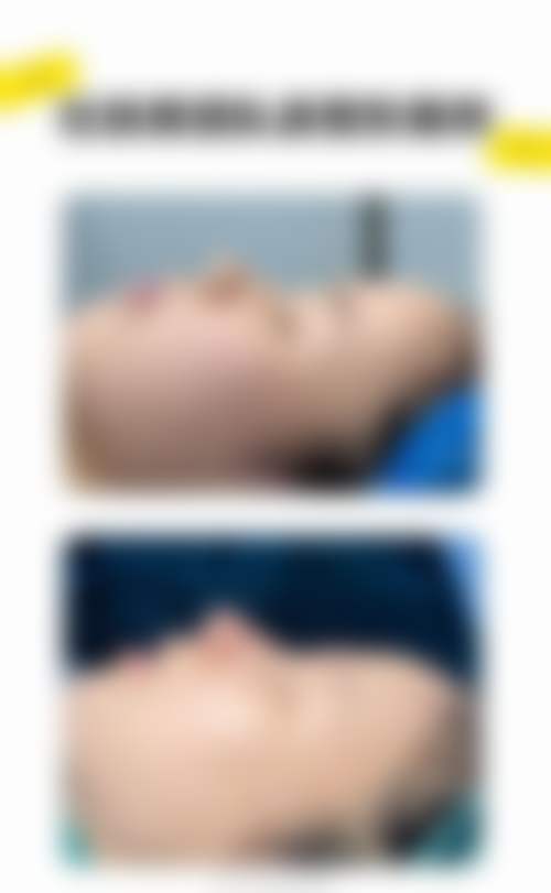 湖州爱尚美医疗美容门诊部患者评价