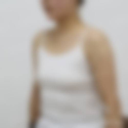 青岛华诺整形美容价格参考