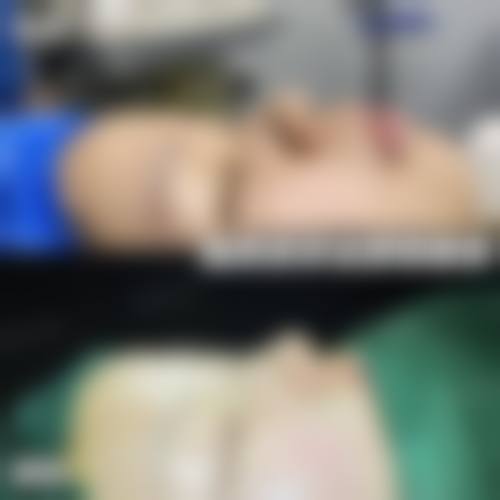 陈秀芸擅长项目列表