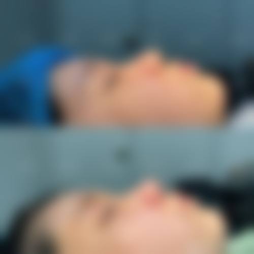 通辽京韩创美美容院核心项目