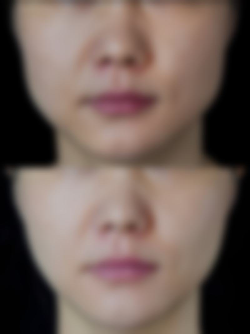 西安天宇医疗美容诊所患者评价