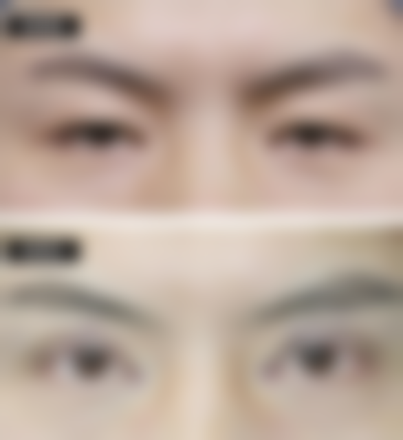 谢又荣擅长项目列表