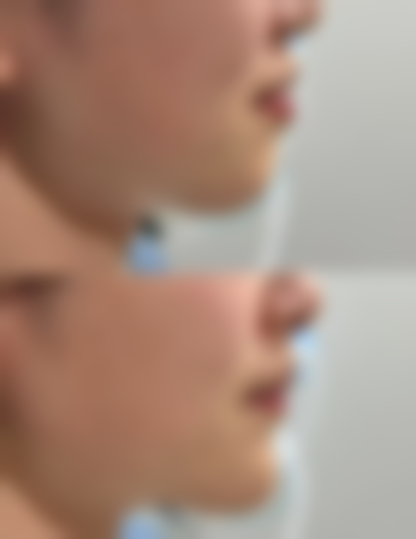 谢又荣预约方式及价格表