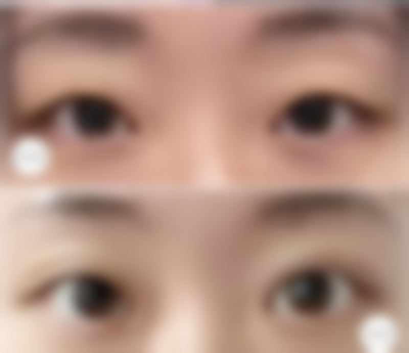 北京爱美整形医疗美容医院患者反馈