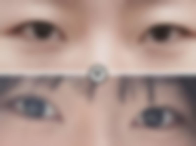 北京爱美整形医疗美容医院价格参考