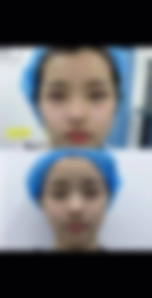 抚顺姚大夫整形医院患者评价