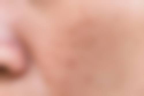 贵港晨妍整形医院价格参考