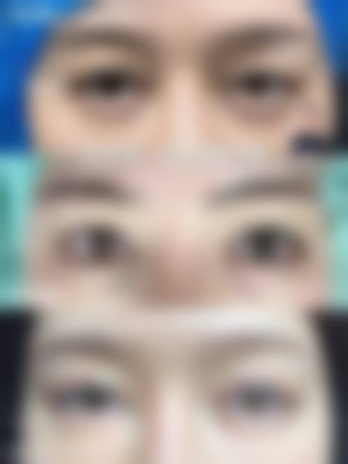 贵港晨妍整形医院患者评价