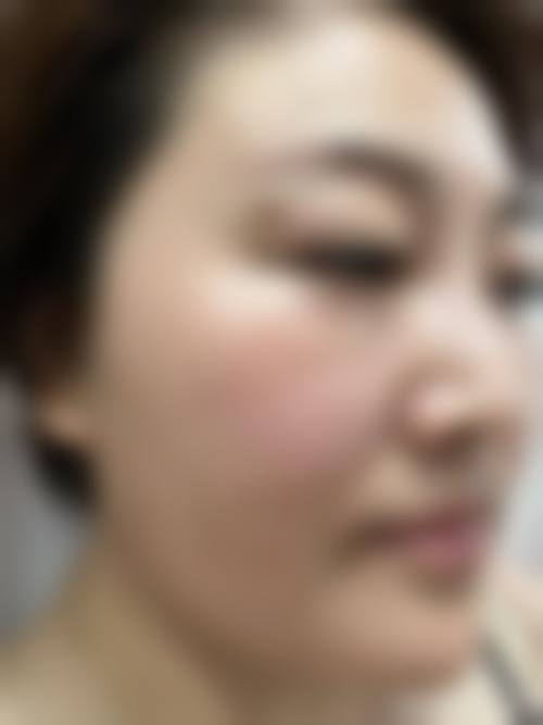 潍坊市人民医院美容整形科价格参考