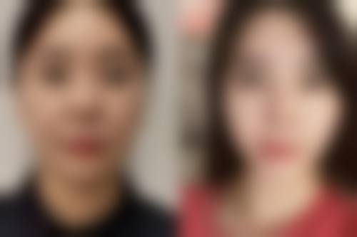 河南濮阳市张大夫整形医生团队