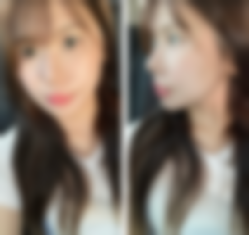 资阳艾唯斯医疗美容诊所正规资质