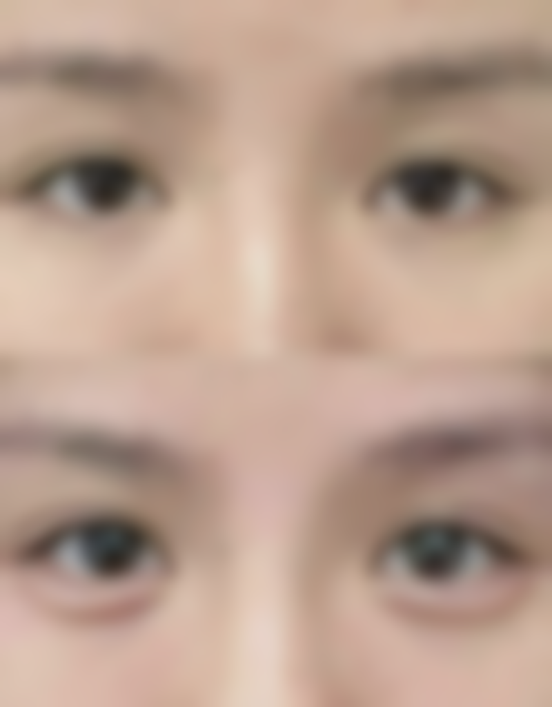 哈尔滨即美整形价格参考