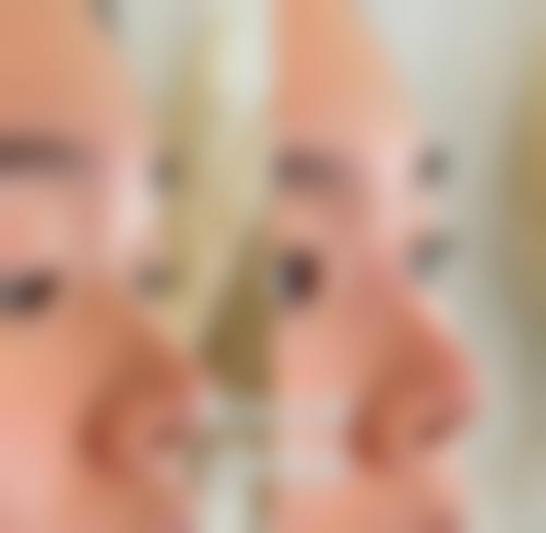 河南科技大学第一附属医院医疗美容科核心项目