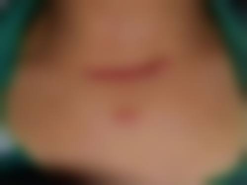 刘海鹰擅长项目列表