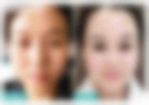 新乡新艺医疗美容诊所价格参考