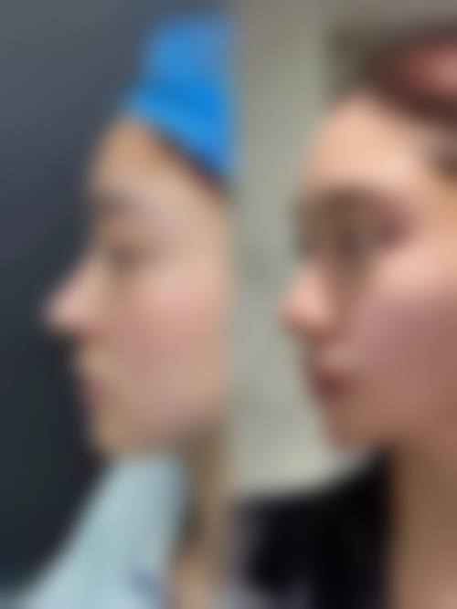 雅安千姿轻美汇整形医院患者评价