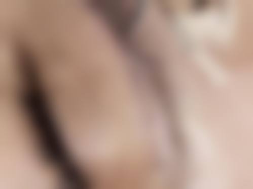 杭州星搏体医疗美容门诊部患者评价