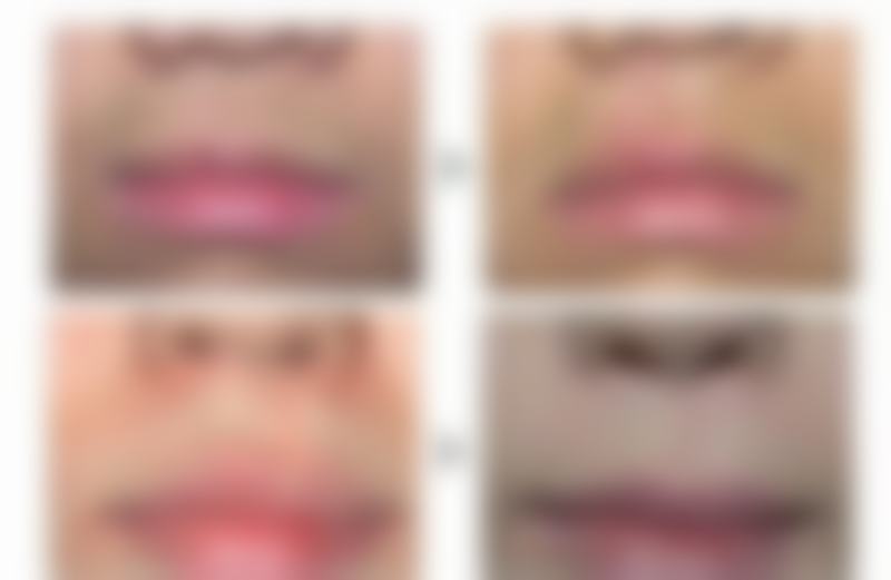 遵义医 科 大学第二附属医院烧伤整形外科医生团队