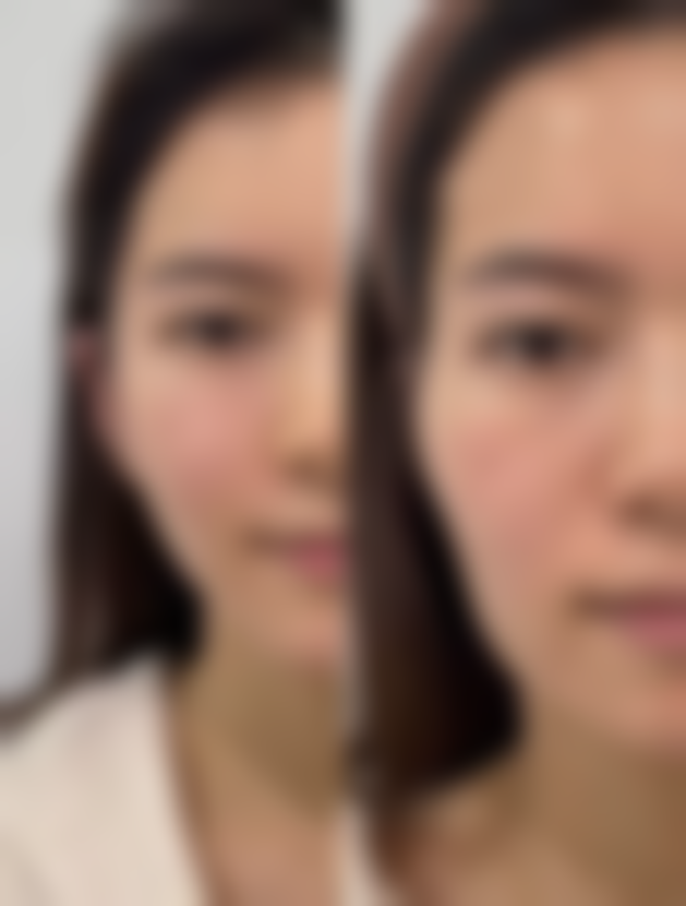 北京杨仁宝医疗美容价格参考