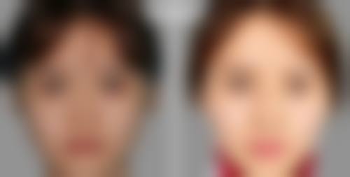 济南俏嘉丽整形医院价格参考