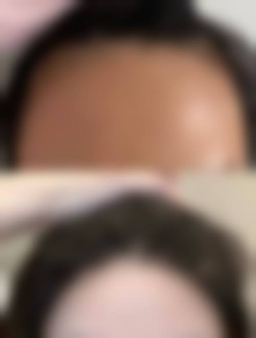 娄底市中医医院(烧伤整形科)核心项目