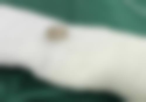 福建省人民医院整形中 心地址及到院路线